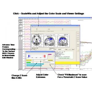 Neuroguide LORETA Source Correlation Normative Database 
